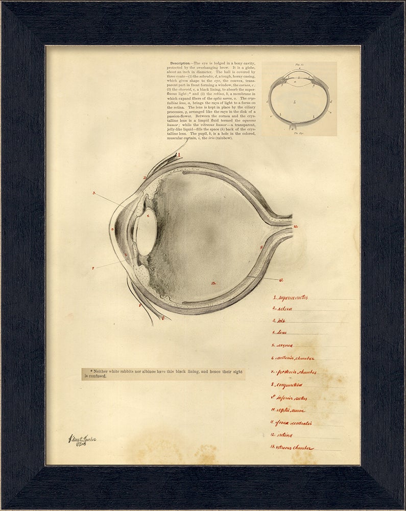 Spicher & Company MI Description of the Eye 11239